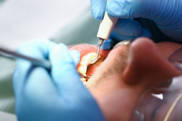 Best Cracked Tooth Emergency Dentist  in Pioneer, OH