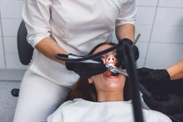 Best Chipped Tooth Repair Near Me  in Pioneer, OH